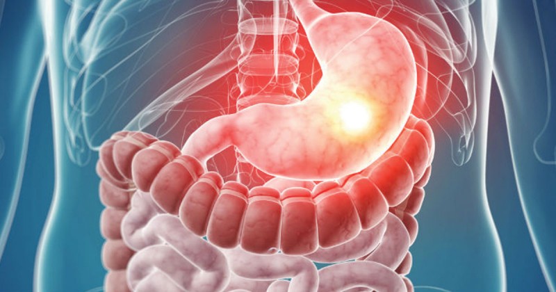 Eglin AFB - Gastroenterology